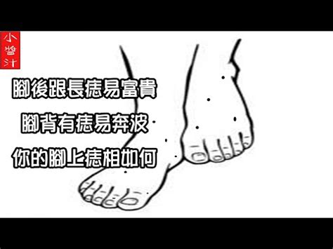 腳心凹|非富即貴！5種腳相註定好命 痣長在這裡「天生帝王命」